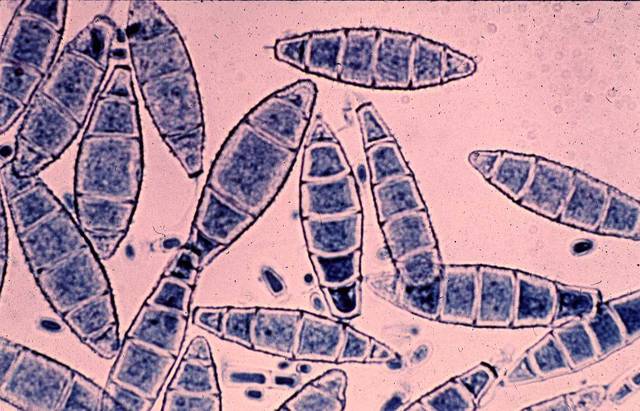 Microsporum gypseum